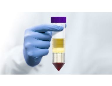 How to Isolate Mononuclear Cells from Blood in 15 Minutes with SepMate™