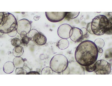 Forskolin-Induced Swelling of Airway Organoids Derived from Healthy and Cystic Fibrosis Donors
