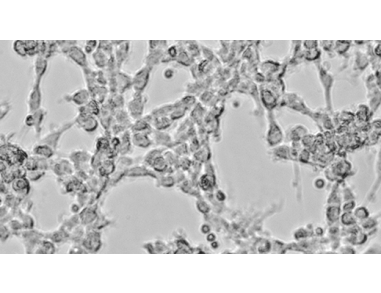How to Co-Culture Human Airway Epithelial and Immune Cells for RSV Infection