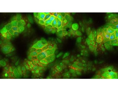How to Generate Monolayers from hPSC-Derived Organoids Using IntestiCult™
