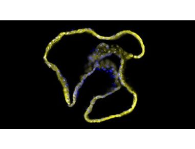 Drug Screening with Human Pancreatic Organoid Cultures
