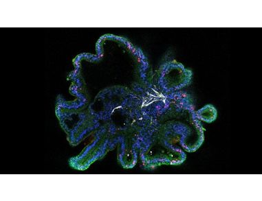 Initiating Intestinal Organoid Differentiation from Single-Cell hPSCs Using STEMdiff™