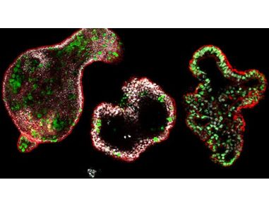 How to Differentiate hiPSCs into Colonic Organoids Using STEMdiff™
