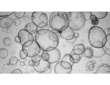 How to Perform Albumin Detection Assays in Human Hepatic Organoids