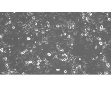 How to Prepare Conditioned Medium for the Expansion of Epithelial Cells