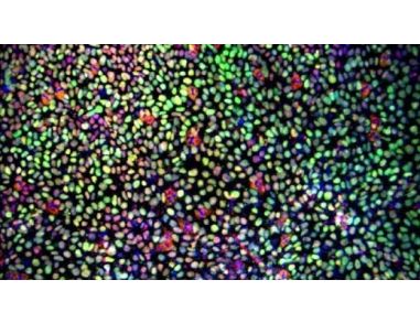 Maintenance of Porcine Pluripotent Stem Cells (pPSCs) Using eTeSR™
