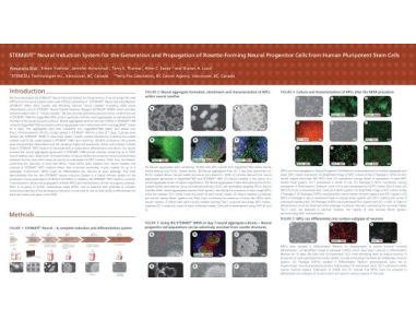 STEMdiff Neural Induction System for the Generation and Propagation of Rosette-Forming Neural Progenitor Cells from Human Pluripotent Stem Cells