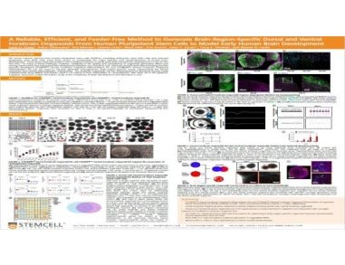 A Reliable, Efficient, and Feeder-Free Method to Generate Brain-Region-Specific Dorsal and Ventral Forebrain Organoids From Human Pluripotent Stem Cells to Model Early Human Brain Development