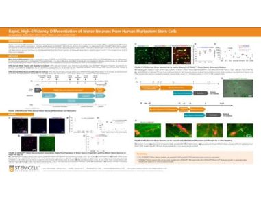 Rapid, High-Efficiency Differentiation of Motor Neurons from Human Pluripotent Stem Cells