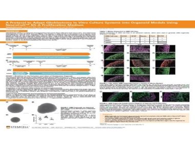 A Protocol to Adapt Glioblastoma In Vitro Culture Systems into Organoid Models Using NeuroCult™ NS-A Proliferation Medium