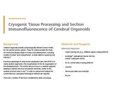 Cryogenic Tissue Processing and Section Immunofluorescence of Cerebral Organoids