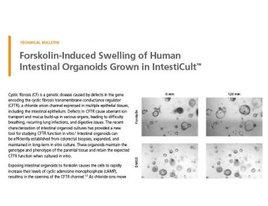Forskolin-Induced Swelling of Human Intestinal Organoids Grown in IntestiCult™