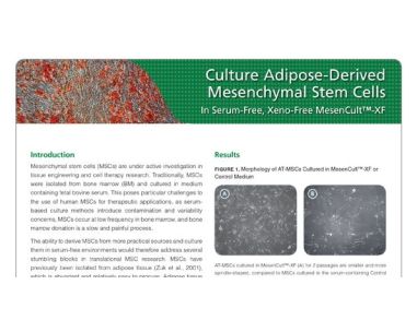 Culture Adipose-Derived Mesenchymal Stem Cells in Serum-Free, Xeno-Free MesenCult™-XF