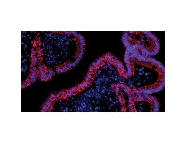 Mouse Intestinal Organoid Course