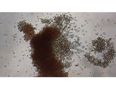 Human Hematopoietic CFU Assay Course
