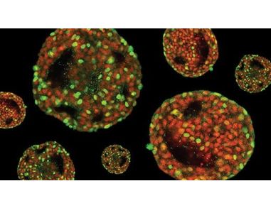 Expansion of hPSCs in 3D Suspension Culture Course