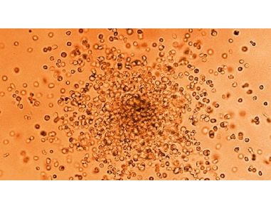 Introduction to STEMvision for CFU Assay Scoring Course