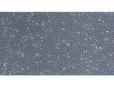 Neural Induction of hPSCs Using the Monolayer Method