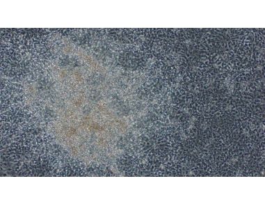 Neural Induction of hPSCs Using the Embryoid Body Method