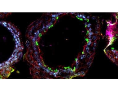 FAQs on Human Airway Organoid Cultures