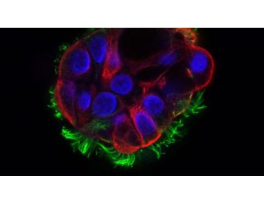 Frequently Asked Questions on PneumaCult™ Apical-Out Airway Organoid Medium