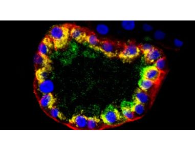 Frequently Asked Questions on PneumaCult™ Alveolar Organoid Media