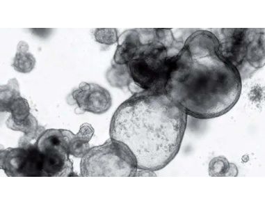 Frequently Asked Questions on STEMdiff™ Intestinal Organoid Kit