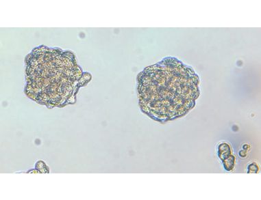 Culture Mammospheres and Tumorspheres with the MammoCult™ Medium