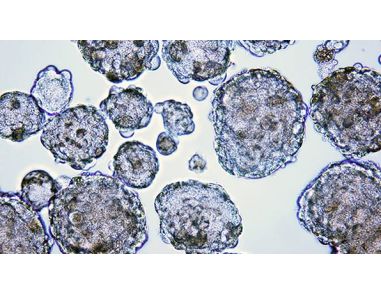 Enumerating Mammospheres and Tumorspheres from Cells Cultured in MammoCult&trade; Medium