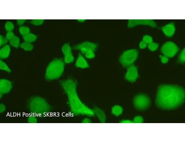 Tools for Breast Cancer Research