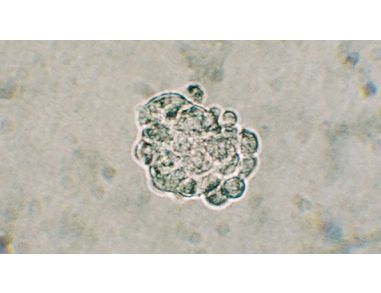 NeuroCult&trade; Neural Colony-Forming Cell (NCFC) Assay