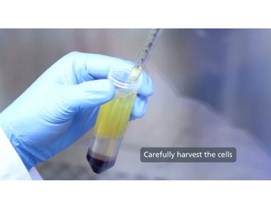 How to Isolate PBMCs from Whole Blood Using Density Gradient Centrifugation (Ficoll™ or Lymphoprep™)