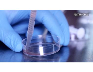 How to Prepare a Single-Cell Suspension from Primary Tissue Samples (e.g. Mouse Spleen)