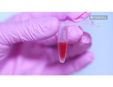 How to Deplete Red Blood Cells from Small Volume Samples with HetaSep™