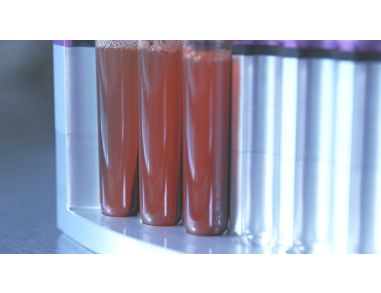 How to Isolate Cells Directly from Whole Blood - EasySep™ Direct Protocol, EasyEights Magnet