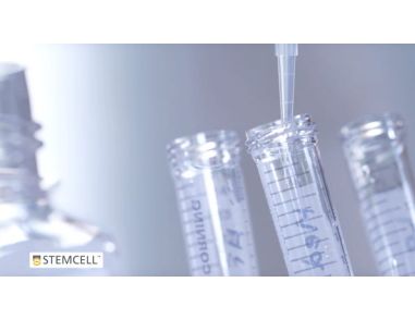 How to Culture Mouse Intestinal Organoids: Passaging