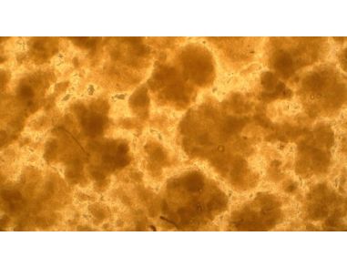 Introducing EpiCult™-C Medium