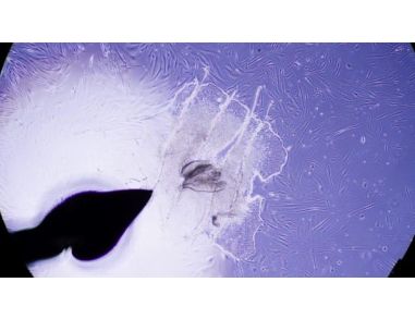 How to Reprogram Fibroblasts into Human Induced Pluripotent Stem (iPS) Cells Using ReproRNA™-OKSGM