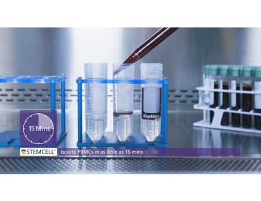 How SepMate™ PBMC Isolation Tubes Work: From Whole Blood to PBMCs in 15 Minutes