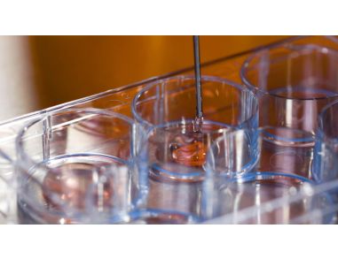 How to Set Up the CFU Assay for Custom Hematopoietic Training Courses Using SmartDish™ 