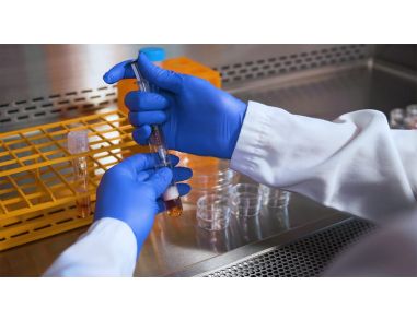 Procedure for Setting Up the CFU Assay