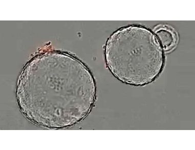 Growth of Pancreatic Organoids in PancreaCult™