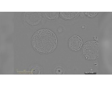 Growth of Liver Organoids in HepatiCult™