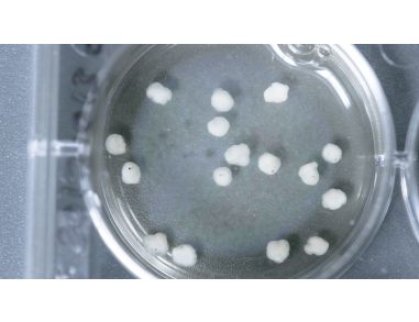 How to Grow Cerebral Organoids