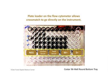 Considerations to Streamline the Flow Cytometry Crossmatch (FCXM) Assay