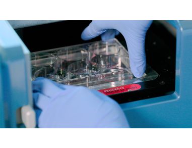 How to Standardize Hematopoietic Colony Counting with STEMvision™
