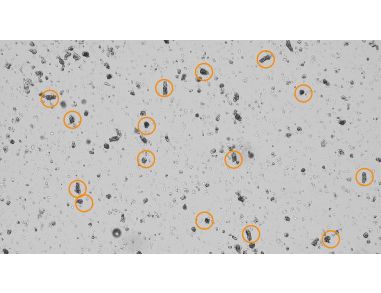 Counting Intestinal Crypts for Organoid Cultures