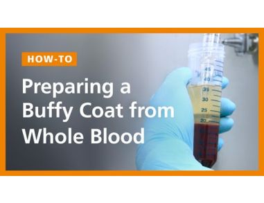 How to Prepare a Buffy Coat from Whole Blood