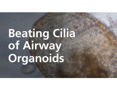 Beating Cilia of Airway Organoids Grown in PneumaCult™