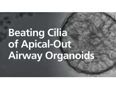 Beating Cilia of an Apical-Out Airway Organoid Grown in PneumaCult™